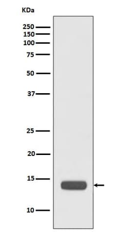 Novus Biologicals RPS20 Antibody (SR3012), Novus Biologicals:Antibodies:Primary