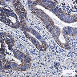 Novus Biologicals MGST3 Antibody (SR2438), Novus Biologicals 100 &mu;L;