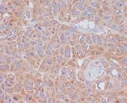 Novus Biologicals ATG9A Antibody (SR3028), Novus Biologicals 100 &mu;L;