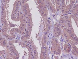 Novus Biologicals MEKK2 Antibody (SR3035), Novus Biologicals 100 &mu;L;