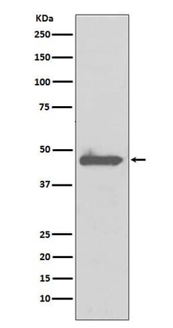 Novus Biologicals Caspase 5 Antibody (SR3060), Novus Biologicals 50 &mu;L;
