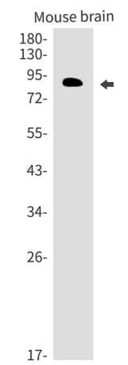 Novus Biologicals PIP5K1C Antibody (SR2466), Novus Biologicals 100 &mu;L;