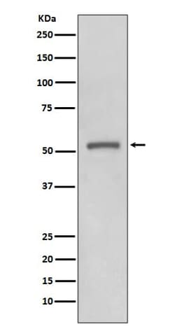 Novus Biologicals MMP-11 Antibody (SR3093), Novus Biologicals:Antibodies:Primary
