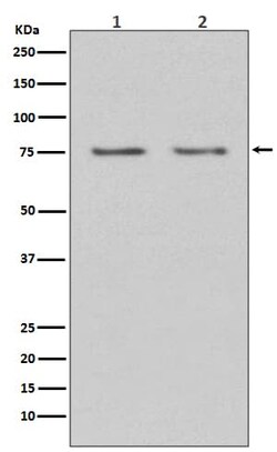 Novus Biologicals HDAC10 Antibody (SR3178), Novus Biologicals:Antibodies:Primary