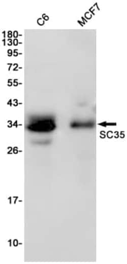 Novus Biologicals SC35 Antibody (SR2484), Novus Biologicals 100 &mu;L;