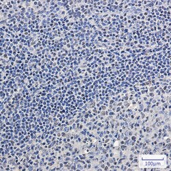 Novus Biologicals SC35 Antibody (SR2484), Novus Biologicals 100 &mu;L;