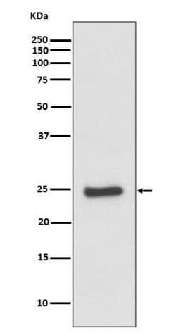 Novus Biologicals ZNRF2 Antibody (SR3261), Novus Biologicals 50 &mu;L;