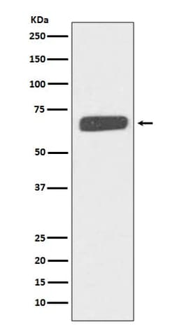 Novus Biologicals Collagen X alpha 1 Antibody (SR3302), Novus Biologicals:Antibodies:Primary