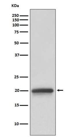 Novus Biologicals Claudin-5 Antibody (SR3444), Novus Biologicals 100 &mu;L;