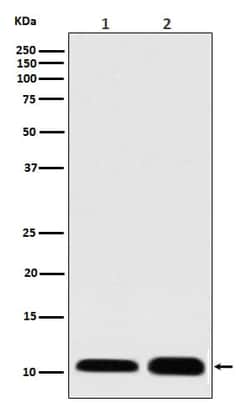 Novus Biologicals S100A/B Antibody (SR3487), Novus Biologicals:Antibodies:Primary