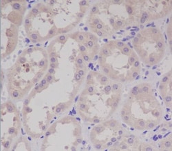 Novus Biologicals S100A/B Antibody (SR3487), Novus Biologicals:Antibodies:Primary