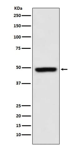 Novus Biologicals MEIS1 Antibody (SR3560), Novus Biologicals 100 &mu;L;