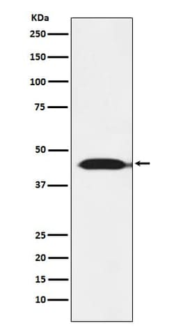 Novus Biologicals Isocitrate Dehydrogenase 2/IDH2 Antibody (SR3576), Novus