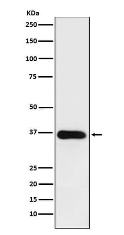 Novus Biologicals 11 beta-HSD1 Antibody (SR3601), Novus Biologicals 50
