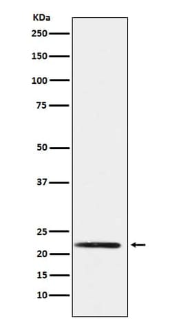 Novus Biologicals PMP22 Antibody (SR3611), Novus Biologicals 50 &mu;L;