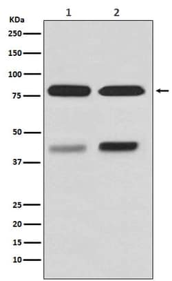 Novus Biologicals PKC beta 1 Antibody (SR3633), Novus Biologicals 50 &mu;L;