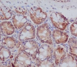 Novus Biologicals PKC beta 1 Antibody (SR3633), Novus Biologicals 50 &mu;L;