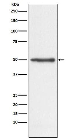 Novus Biologicals Nogo Antibody (SR3702), Novus Biologicals:Antibodies:Primary