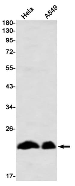 Novus Biologicals PMF1 Antibody (SR2536), Novus Biologicals 100 &mu;L;