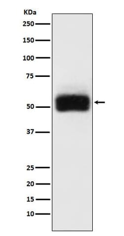 Novus Biologicals MMP-17 Antibody (SR3715), Novus Biologicals:Antibodies:Primary