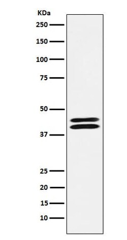 Novus Biologicals PON2 Antibody (SR3802), Novus Biologicals:Antibodies:Primary