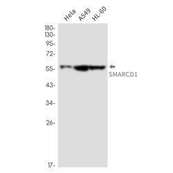 Novus Biologicals SMARCD1 Antibody (SR2544), Novus Biologicals 100 &mu;L;