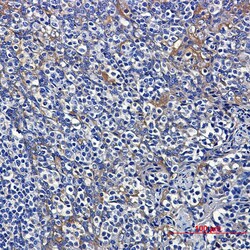 Novus Biologicals DYNLT1 Antibody (SR2546), Novus Biologicals 100 &mu;L | Buy Online | Novus Biologicals&trade; | Fisher Scientific