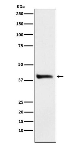Novus Biologicals alcohol dehydrogenase Antibody (SR3872), Novus Biologicals:Antibodies:Primary