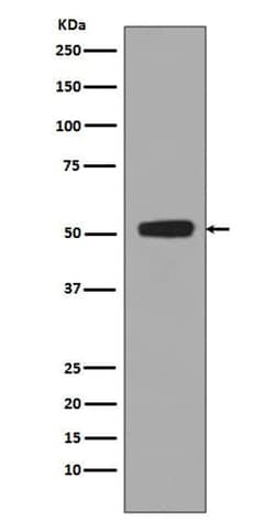 Novus Biologicals p53 [p Ser376] Antibody (SR1943), Novus Biologicals 50 &mu;L | Buy Online | Novus Biologicals&trade; | Fisher Scientific