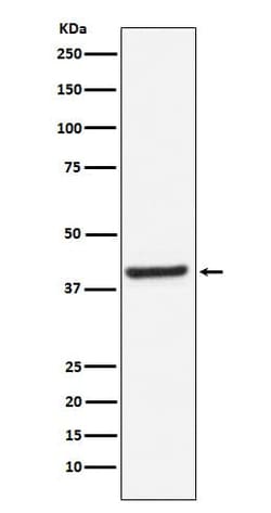 Novus Biologicals Inhibin beta A Antibody (SR4080), Novus Biologicals:Antibodies:Primary