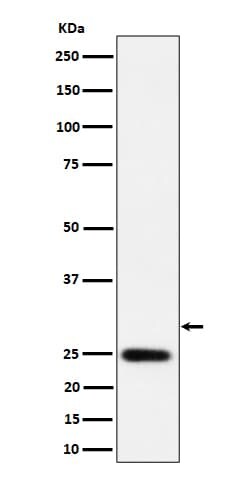 Novus Biologicals NAT1 Antibody (SR4177), Novus Biologicals:Antibodies:Primary