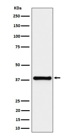 Novus Biologicals UIP1 Antibody (SR4268), Novus Biologicals:Antibodies:Primary