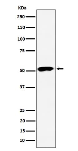 Novus Biologicals PPP2R5E Antibody (SR4281), Novus Biologicals 100 &mu;L;