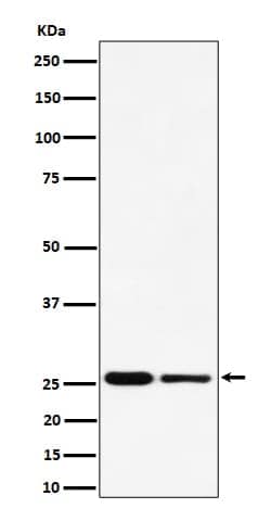 Novus Biologicals PMF1 Antibody (SR4288), Novus Biologicals 100 &mu;L;