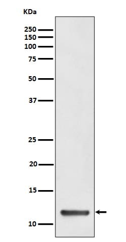 Novus Biologicals DYNLT1 Antibody (SR4309), Novus Biologicals 50 &mu;L;
