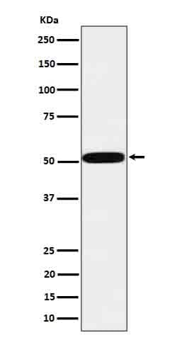 Novus Biologicals HTRA1/PRSS11 Antibody (SR4329), Novus Biologicals:Antibodies:Primary