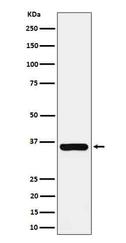 Novus Biologicals gamma-glutamyl hydrolase Antibody (SR4337), Novus Biologicals