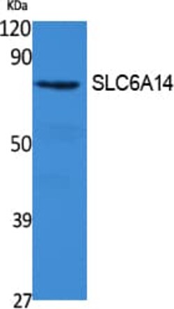 Novus Biologicals SLC6A14 Antibody, Novus Biologicals 100 &mu;L; Unconjugated:Antibodies,