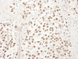 Novus Biologicals UBL7 Antibody, Novus Biologicals 100 &mu;g, Unconjugated:Antibodies,