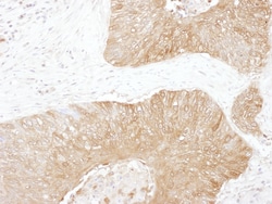 Novus Biologicals Glucose 6 phosphate isomerase Antibody, Novus Biologicals