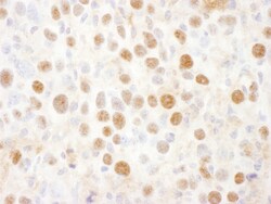 Novus Biologicals Proteasome 19S 10B Antibody, Novus Biologicals 100 &mu;g,