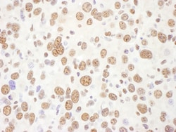 Novus Biologicals EIF4A3 Antibody, Novus Biologicals 100 &mu;g, Unconjugated:Antibodies,