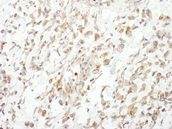 Novus Biologicals Cullin 1 Antibody, Novus Biologicals 100 &mu;g, Unconjugated:Antibodies,