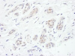 Novus Biologicals FoxC1 Antibody, Novus Biologicals 100 &mu;g, Unconjugated:Antibodies,