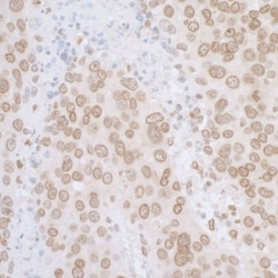 Novus Biologicals Thymopoietin/LAP2 Antibody, Novus Biologicals 100 &mu;g,