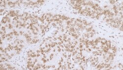 Novus Biologicals Thymopoietin/LAP2 Antibody, Novus Biologicals 100 &mu;g | Buy Online | Novus Biologicals&trade; | Fisher Scientific