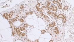 Novus Biologicals Thymopoietin/LAP2 Antibody, Novus Biologicals 100 &mu;g | Buy Online | Novus Biologicals&trade; | Fisher Scientific