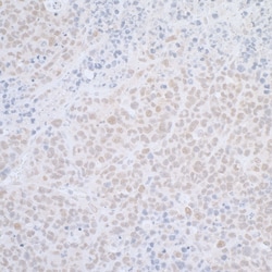 Novus Biologicals ELAC2 Antibody, Novus Biologicals 100 &mu;g, Unconjugated:Antibodies,
