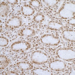 Novus Biologicals ELAC2 Antibody, Novus Biologicals 100 &mu;g, Unconjugated:Antibodies,