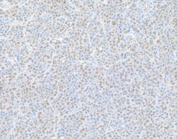 Novus Biologicals Rpn2 Antibody, Novus Biologicals 100 &mu;g, Unconjugated:Antibodies,